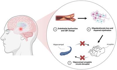 Amygdala and cognitive impairment in cerebral small vessel disease: structural, functional, and metabolic changes